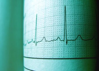 Terremoto a Messina: la Terra trema, paura e gente in strada